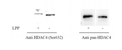 Sandwich ELISA - Phospho-HDAC4 (S632) and Total HDAC4 ELISA Kit (AB279821), expandable thumbnail