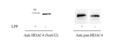 Sandwich ELISA - Phospho-HDAC4 (S632) and Total HDAC4 ELISA Kit (AB279821)