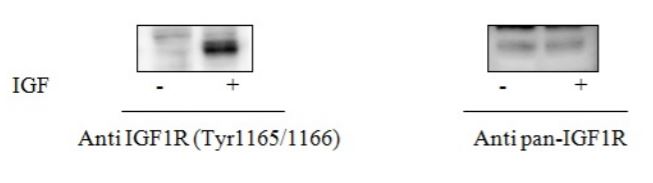 Sandwich ELISA - Phospho-IGF1 Receptor (Y1165/1166) ELISA Kit (AB279825)