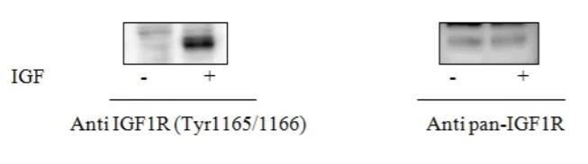 Sandwich ELISA - Phospho-IGF1 Receptor (Y1165/1166) ELISA Kit (AB279825)