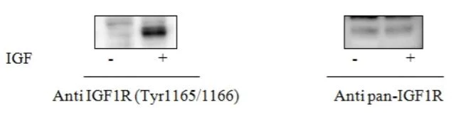 Sandwich ELISA - Phospho-IGF1 Receptor (Y1165/Y1166) and Total IGF1 Receptor ELISA Kit (AB279826)
