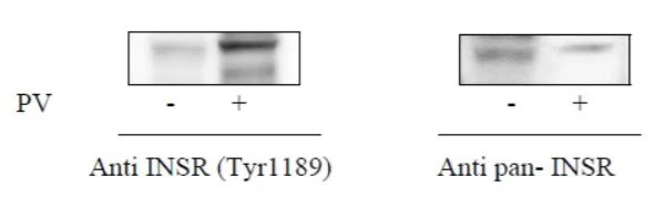 Sandwich ELISA - Phospho-Insulin Receptor (Y1189) and Total Insulin Receptor ELISA Kit (AB279831)