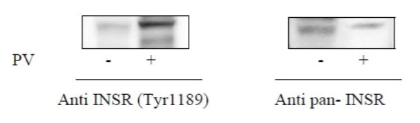Sandwich ELISA - Phospho-Insulin Receptor (Y1189) ELISA Kit (AB279830)