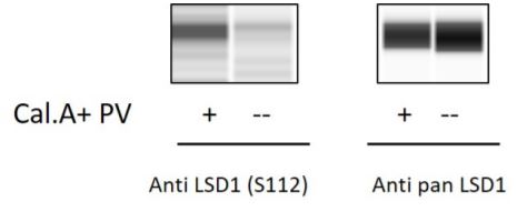 Sandwich ELISA - Phospho-KDM1/LSD1 (S112) and Total KDM1/LSD1 ELISA Kit (AB279853), expandable thumbnail