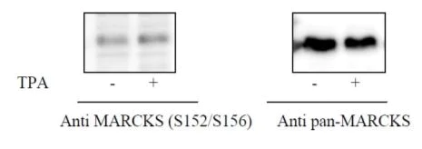 Sandwich ELISA - Phospho-MARCKS (S152/156) ELISA Kit (AB279856)