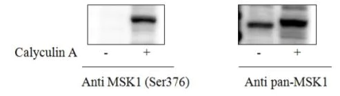 Sandwich ELISA - Phospho-MSK1 (S376) and Total MSK1 ELISA Kit (AB279865)