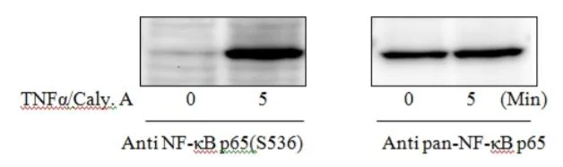 Sandwich ELISA - Phospho-NF-kB p65 (S536) ELISA Kit (AB279873)