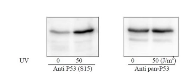 Sandwich ELISA - Phospho-p53 (S15) and Total p53 ELISA Kit (AB279878), expandable thumbnail
