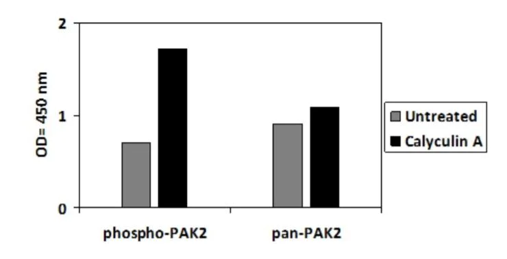 Sandwich ELISA - Phospho-PAK2 (S20) and Total PAK2 ELISA Kit (AB279883)