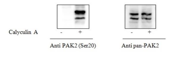 Sandwich ELISA - Phospho-PAK2 (S20) ELISA Kit (AB279882), expandable thumbnail