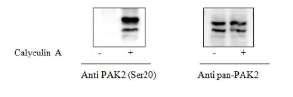 Sandwich ELISA - Phospho-PAK2 (S20) ELISA Kit (AB279882)