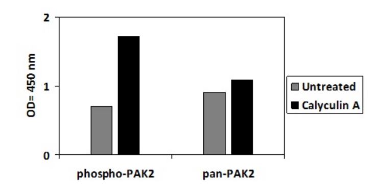 Sandwich ELISA - Phospho-PAK2 (S20) ELISA Kit (AB279882), expandable thumbnail