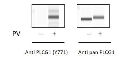 Sandwich ELISA - Phospho-Phospholipase C gamma 1/PLC-gamma-1 (Y771) ELISA Kit (AB279892)