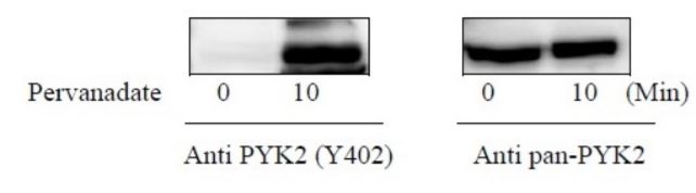 Sandwich ELISA - Phospho-PYK2 (Y402) and Total PYK2 ELISA Kit (AB279902), expandable thumbnail