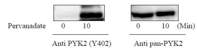 Sandwich ELISA - Phospho-PYK2 (Y402) and Total PYK2 ELISA Kit (AB279902)