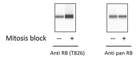 Sandwich ELISA - Phospho-Rb (T826) ELISA Kit (AB279905)