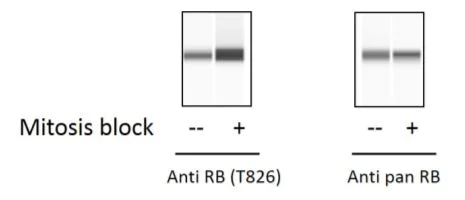 Sandwich ELISA - Phospho-Rb (T826) ELISA Kit (AB279905)