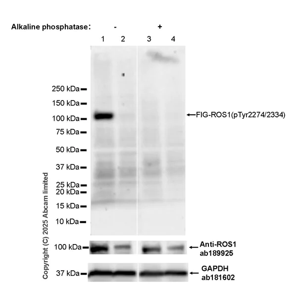 Western blot - Anti-Phospho-ROS1 (Tyr2274/2334) antibody [EPR28163-133] (AB324617)