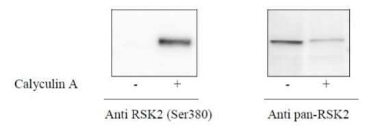 Sandwich ELISA - Phospho-RSK2 (S386) and Total RSK2 ELISA Kit (AB279917)