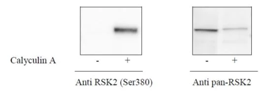 Sandwich ELISA - Phospho-RSK2 (S386) ELISA Kit (AB279916)