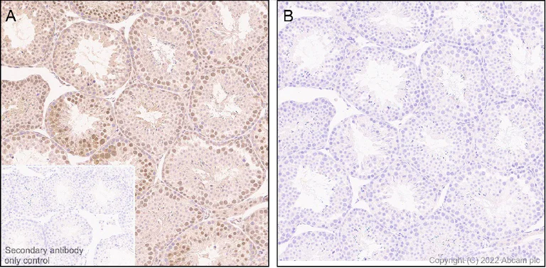 Immunohistochemistry (Formalin/PFA-fixed paraffin-embedded sections) - Anti-Phospho - (Ser/Thr) Phe antibody [EPR26858-4] (AB300625)