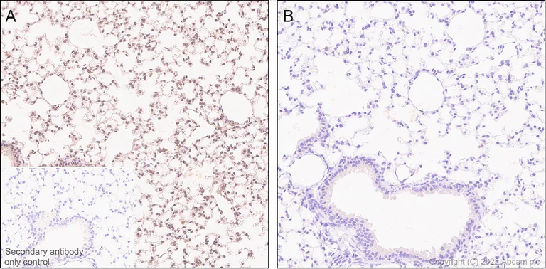 Immunohistochemistry (Formalin/PFA-fixed paraffin-embedded sections) - Anti-Phospho - (Ser/Thr) Phe antibody [EPR26858-4] (AB300625)