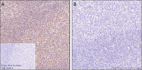 Immunohistochemistry (Formalin/PFA-fixed paraffin-embedded sections) - Anti-Phospho - (Ser/Thr) Phe antibody [EPR26858-4] - BSA and Azide free (AB300626)