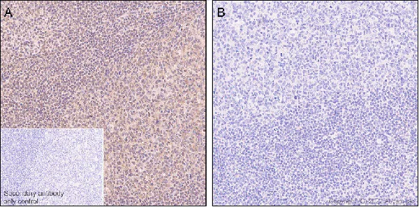 Immunohistochemistry (Formalin/PFA-fixed paraffin-embedded sections) - Anti-Phospho - (Ser/Thr) Phe antibody [EPR26858-4] - BSA and Azide free (AB300626)