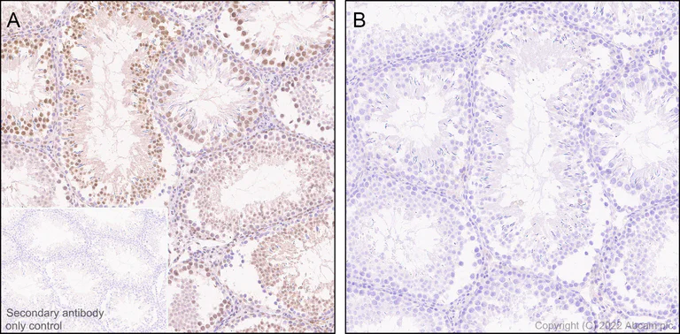 Immunohistochemistry (Formalin/PFA-fixed paraffin-embedded sections) - Anti-Phospho - (Ser/Thr) Phe antibody [EPR26858-4] - BSA and Azide free (AB300626)