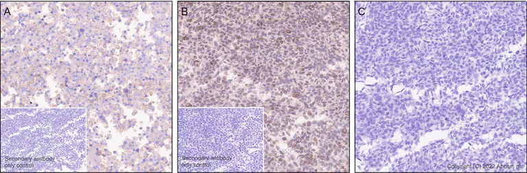 Immunohistochemistry (Formalin/PFA-fixed paraffin-embedded sections) - Anti-Phospho - (Ser/Thr) Phe antibody [EPR26858-4] - BSA and Azide free (AB300626)