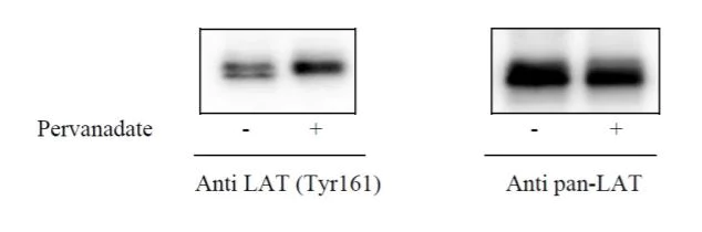 Sandwich ELISA - Phospho-SLC7A5/LAT1 (Y161) and Total SLC7A5/LAT1 ELISA Kit (AB279846)