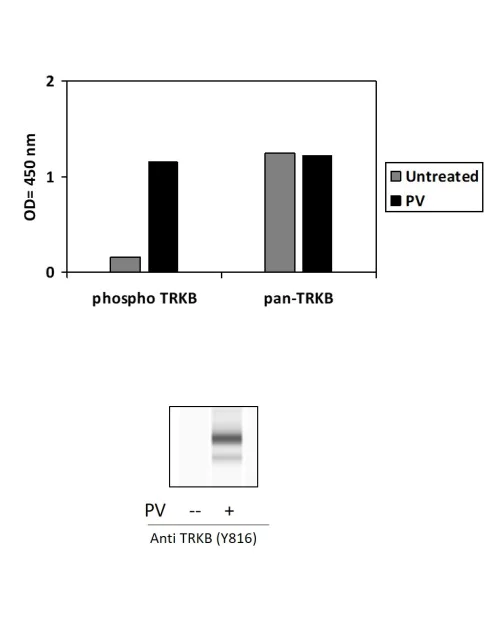 Sandwich ELISA - Phospho-TrkB (Y816) and Total TrkB ELISA Kit (AB279959)