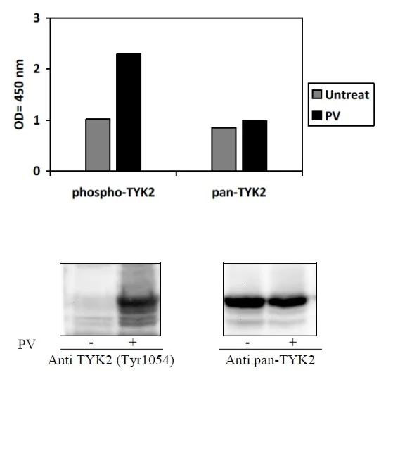 Sandwich ELISA - Phospho-TYK2 (Y1054) and Total TYK2 ELISA Kit (AB279963)