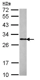 Western blot - Anti-Phospho1 antibody (AB101520)