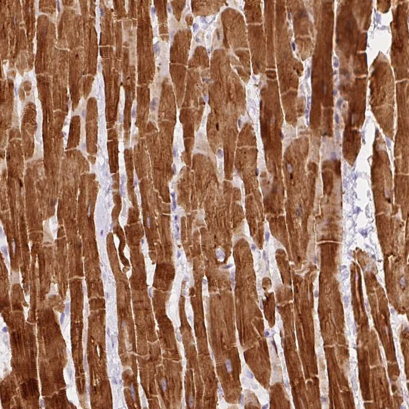 Immunohistochemistry (Formalin/PFA-fixed paraffin-embedded sections) - Anti-Phospho1 antibody (AB272655), expandable thumbnail