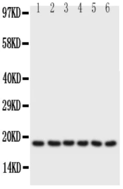 Western blot - Anti-Phospholamban antibody (AB86930)