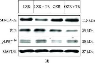 Western blot - Anti-Phospholamban antibody (AB86930)