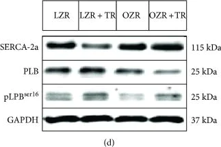 Western blot - Anti-Phospholamban antibody (AB86930)