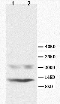 Western blot - Anti-Phospholamban antibody (AB86930)