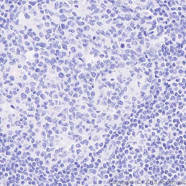 Immunohistochemistry (Formalin/PFA-fixed paraffin-embedded sections) - Anti-Phospholamban antibody [EPR21897] (AB219626), expandable thumbnail