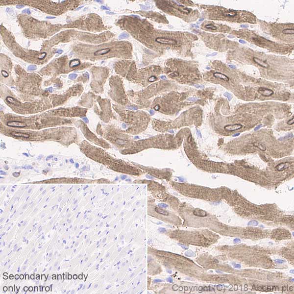 Immunohistochemistry (Formalin/PFA-fixed paraffin-embedded sections) - Anti-Phospholamban antibody [EPR21897] (AB219626), expandable thumbnail