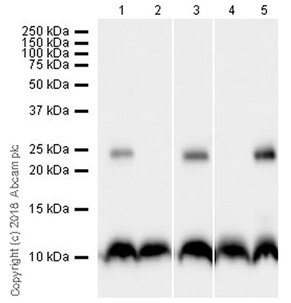Western blot - Anti-Phospholamban antibody [EPR21897] (AB219626), expandable thumbnail