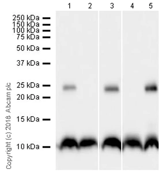 Western blot - Anti-Phospholamban antibody [EPR21897] (AB219626)