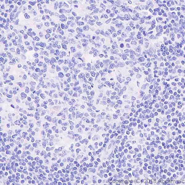Immunohistochemistry (Formalin/PFA-fixed paraffin-embedded sections) - Anti-Phospholamban antibody [EPR21897] - BSA and Azide free (AB234903)