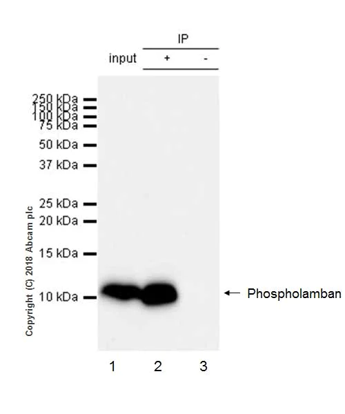Immunoprecipitation - Anti-Phospholamban antibody [EPR21897] - BSA and Azide free (AB234903)