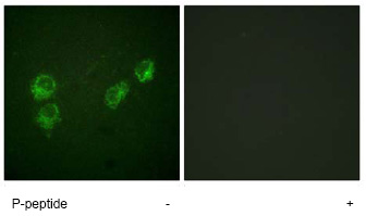Immunocytochemistry/ Immunofluorescence - Anti-Phospholamban (phospho S16 + T17) antibody (AB62170)