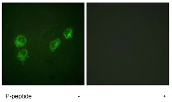 Immunocytochemistry/ Immunofluorescence - Anti-Phospholamban (phospho S16 + T17) antibody (AB62170)