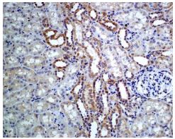 Immunohistochemistry (Formalin/PFA-fixed paraffin-embedded sections) - Anti-Phospholipase A2 activator protein (PLAP) antibody [EPR5481] (AB133589)