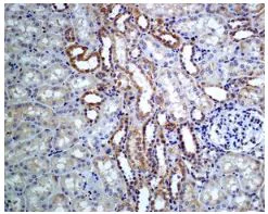 Immunohistochemistry (Formalin/PFA-fixed paraffin-embedded sections) - Anti-Phospholipase A2 activator protein (PLAP) antibody [EPR5481] (AB133589)