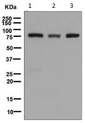 Western blot - Anti-Phospholipase A2 activator protein (PLAP) antibody [EPR5481] (AB133589)